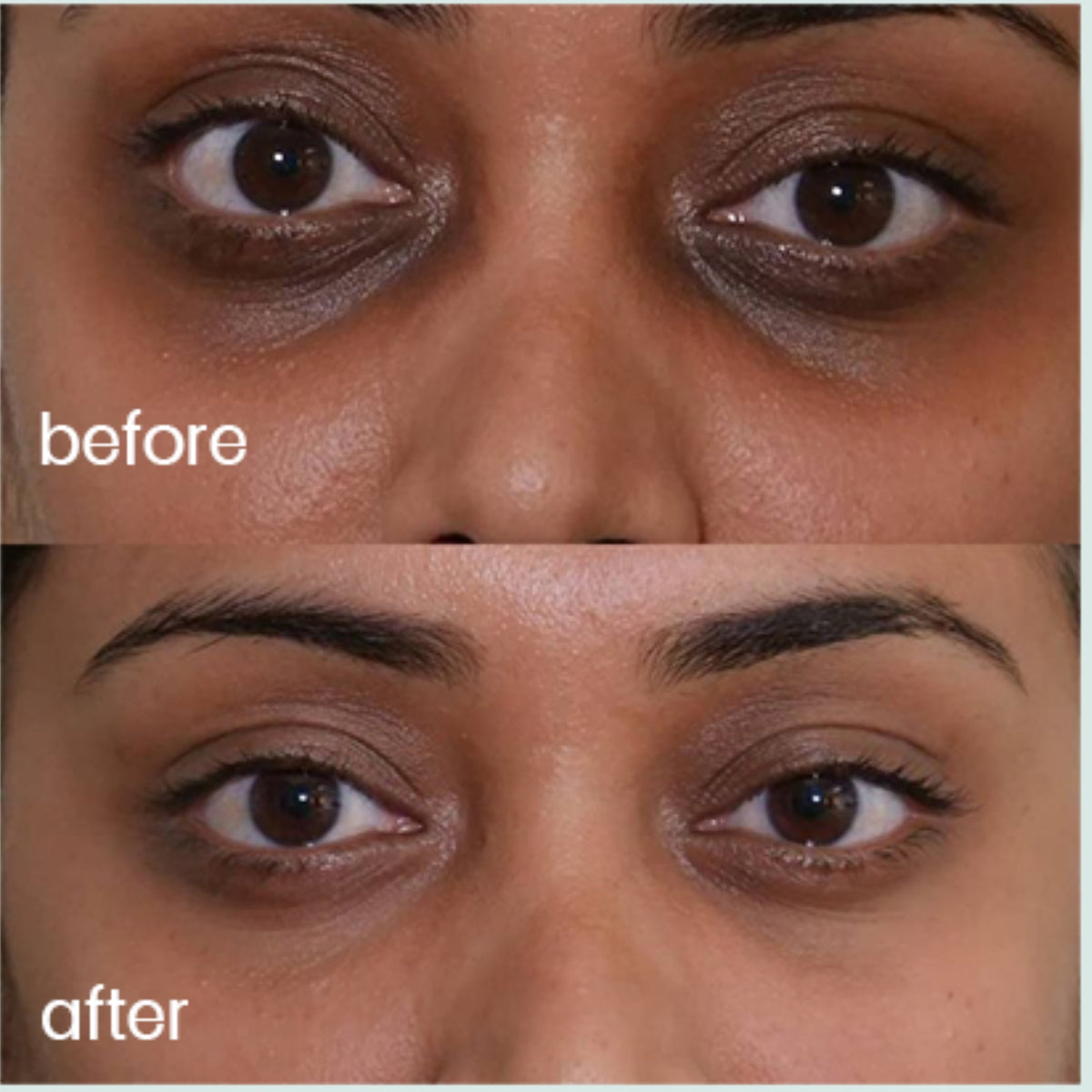 Varnyam Under Eye Cream | Brightening & Anti-Aging Eye Cream - Velleja