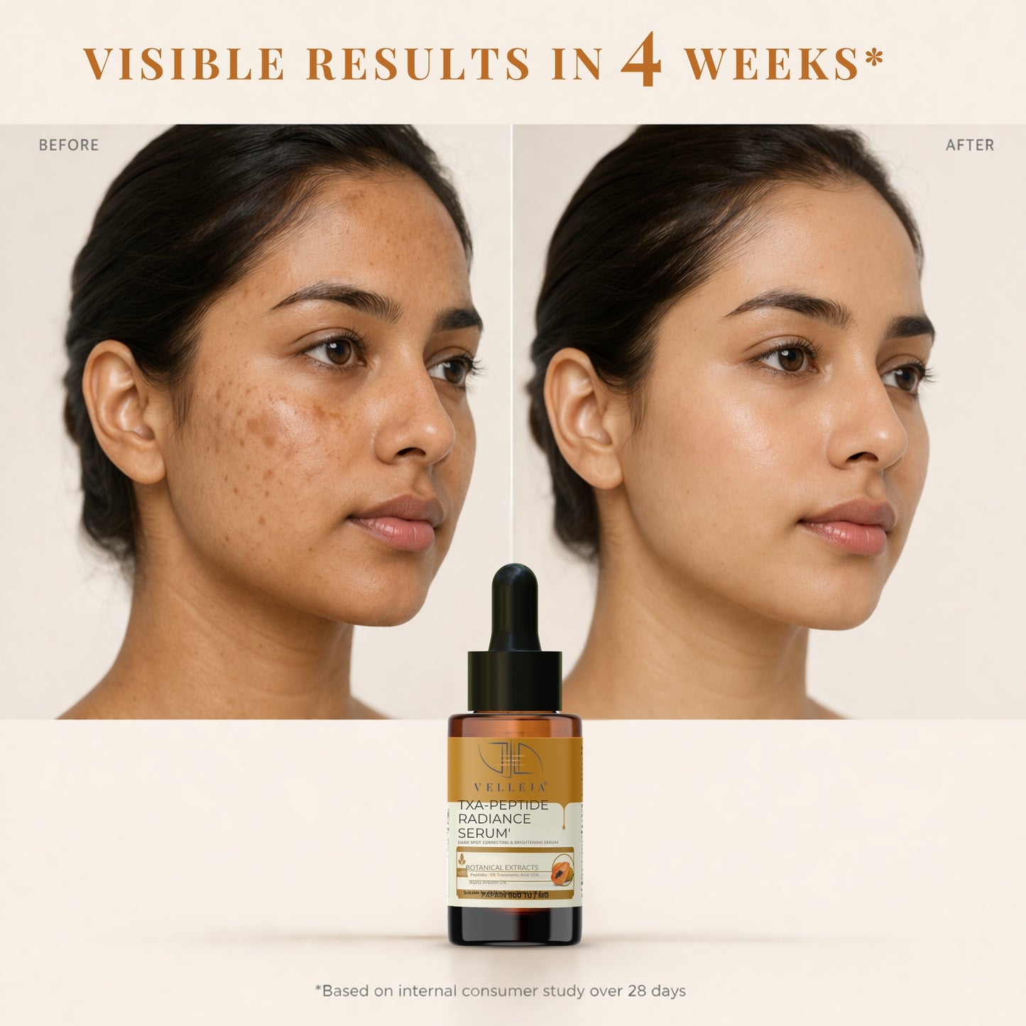 TXA Peptides Face Serum for Dark Spots, Pigmentation, Melasma & Uneven Skin Tone