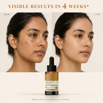 TXA Peptides Face Serum for Dark Spots, Pigmentation, Melasma & Uneven Skin Tone