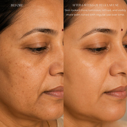 Kumkumadi Face Oil with Kashmiri Saffron & Sandalwood | Ayurvedic Anti Aging Face Serum for Brightening, Dark Spots & Pigmentation