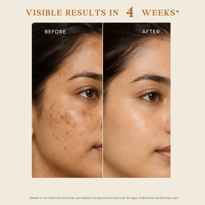 TXA Peptides Face Serum | For Dark Spots, Pigmentation & Melasma - Velleja